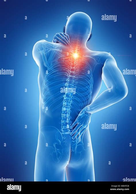 Back pain, computer illustration Stock Photo - Alamy