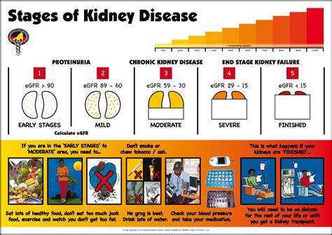 Kidney Disease Diet Chart