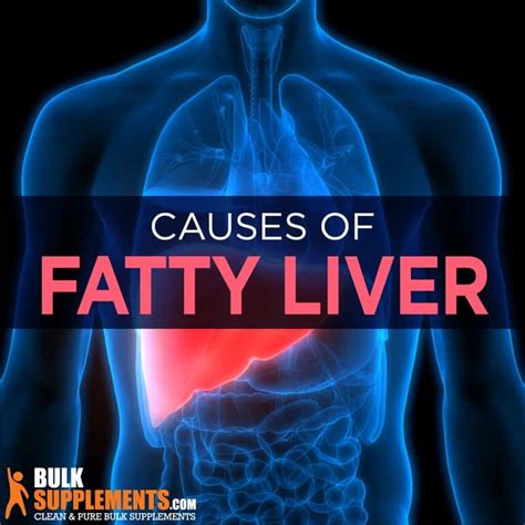 Fatty Liver Disease. Get the Supplements You Need.