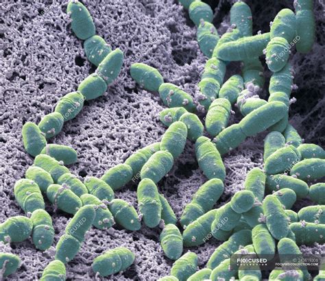 Colored scanning electron micrograph of Streptococcus mutans anaerobic ...