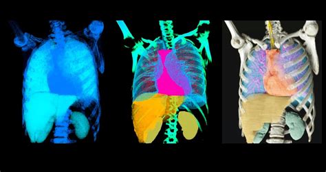 NVIDIA and 75 Healthcare Partners Power Future of Radiology | NVIDIA Blog