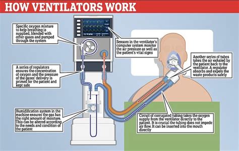 How ventilators work: : r/Infographics