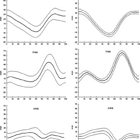 (PDF) Gait Pattern in Inherited Cerebellar Ataxias