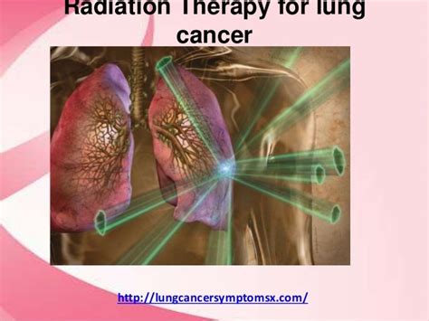 Radiation therapy for lung cancer