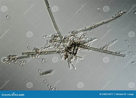 Mold filaments and spores stock image. Image of pollutants - 248210477