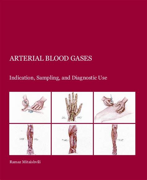 Understanding Laboratory and Diagnostic Tests: Arterial Blood Gas Sampling