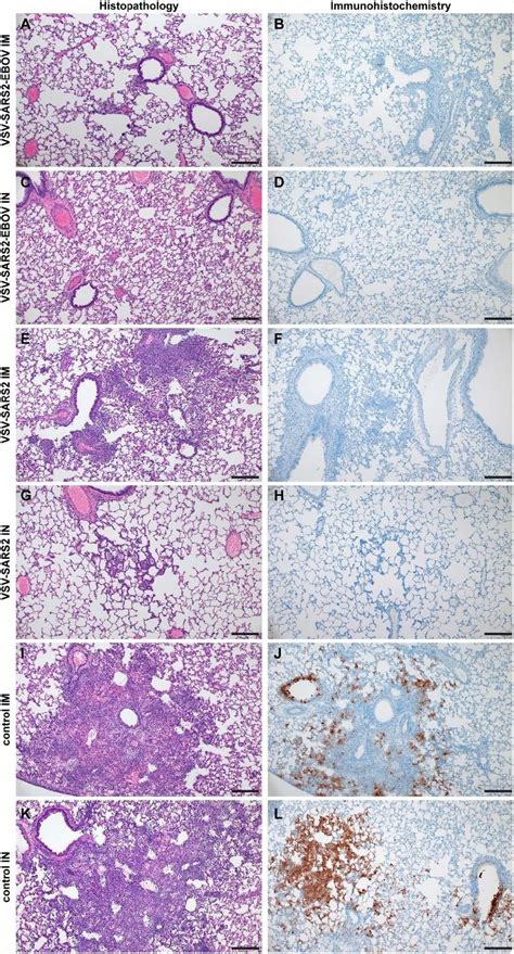 Vesicular Stomatitis Virus-based COVID Vaccines Demonstrate Potent ...