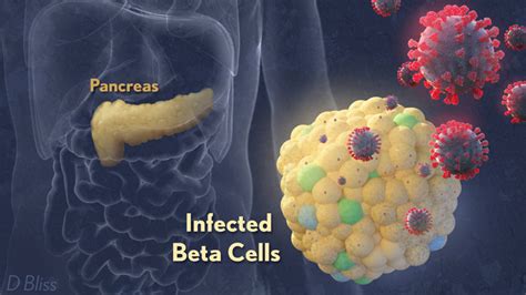 Breathing Labs – How COVID-19 Can Lead to Diabetes – NIH Director’s Blog