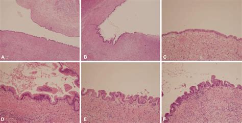 Liver Histology Bile Duct