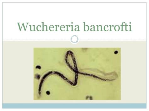 Wuchereria bancrofti