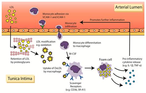 JCM | Free Full-Text | Inflammation as a Therapeutic Target in Atherosclerosis