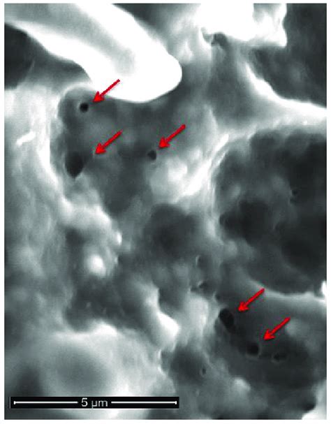 Scanning electron microscopy of irreversible electroporation... | Download Scientific Diagram