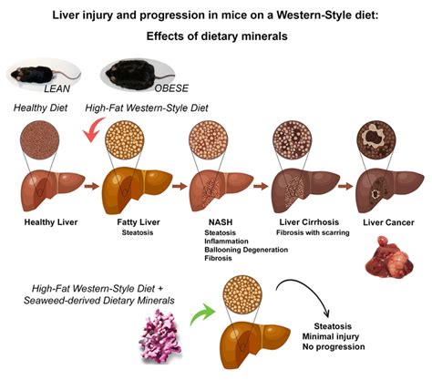 Mineral supplement could stop fatty liver dis | EurekAlert!