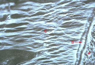 Oral Histology Digital Lab: Periodontium: Intermediate Plexus of ...