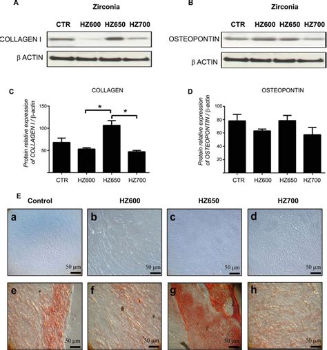 Expression of osteoblast maturation markers and mineralization. (A) and ...