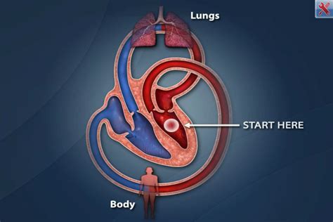 Cardiac Catheterization app uses visual animations for patient education about heart procedures