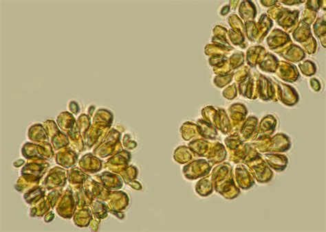 golden-brown algae – Liberal Dictionary