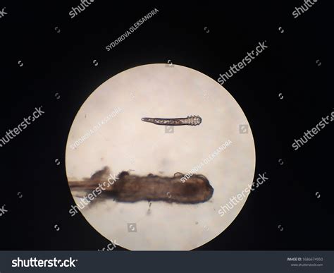 Demodex Mite Under Microscope Eyelash Hair Stock Photo 1686674950 | Shutterstock