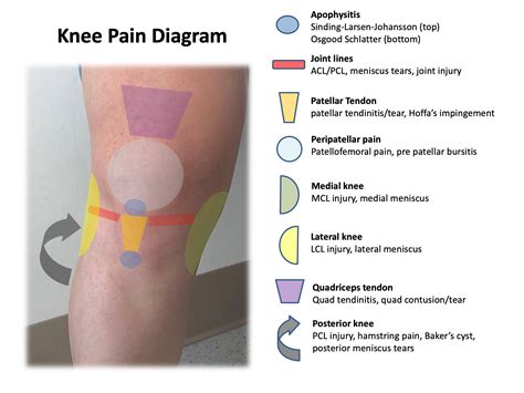 Knee Anatomy Chart