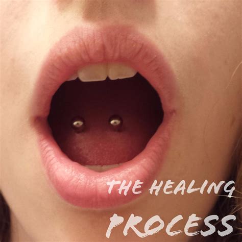 The Healing Process of a Tongue Piercing (With Pictures) - TatRing