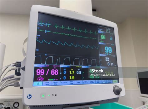 Hospital Monitors Display Vital Signs Heart Rate Oxygen Saturation Temperature Co2 Levels Blood ...