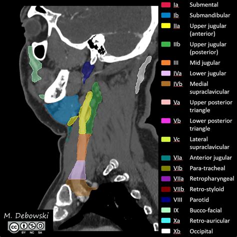 Lymph Node Levels Of The Head And Neck Annotated Ct Image | My XXX Hot Girl