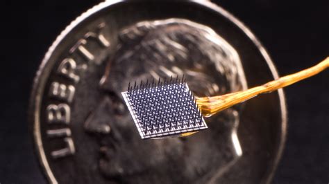 Brain implant | Science News