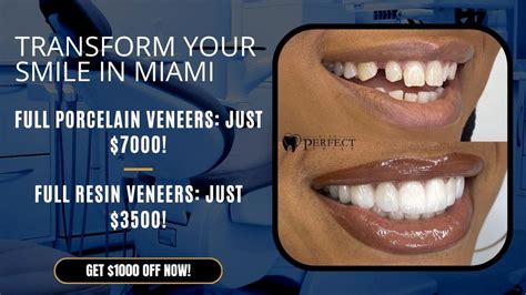 Composite Veneers Pros And Cons