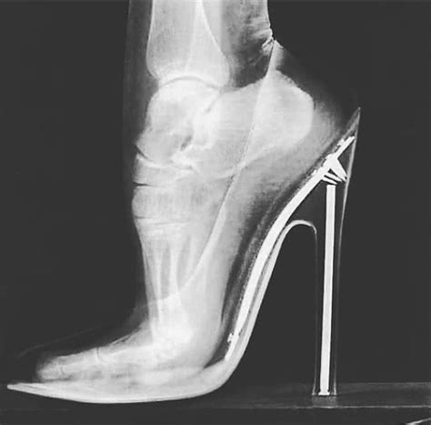 1. The X-ray below shows how wearing high heels exert considerable pressure on the bones ...