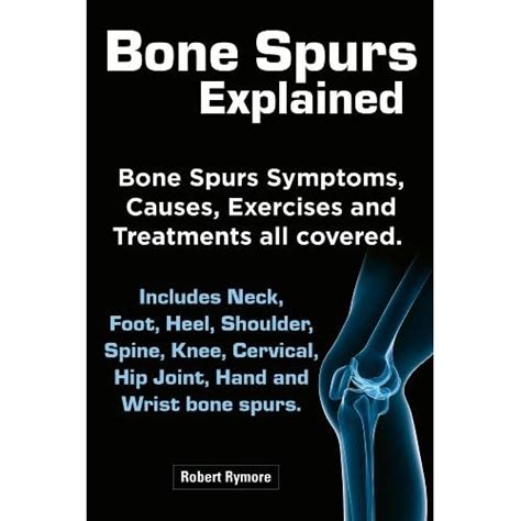 Image: Bone Spurs explained. Bone Spurs Symptoms, Causes, Exercises and ...