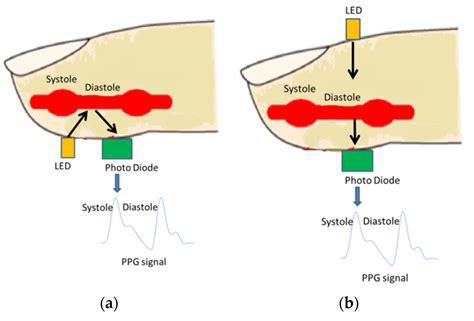 Applied Sciences | Free Full-Text | Classification of Photoplethysmographic Signal Quality with ...