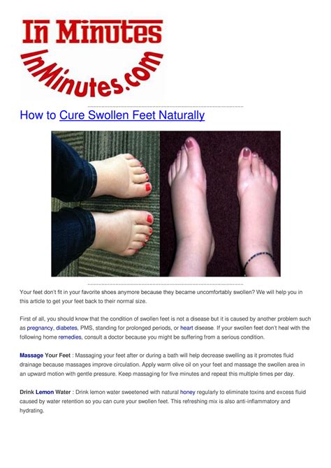 My publications - How to Cure Swollen Feet Naturally - Page 1 - Created ...