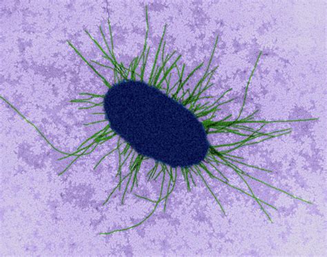 E. Coli With Fimbriae #2 Photograph by Dennis Kunkel Microscopy/science ...