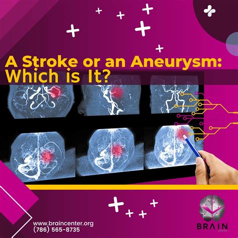 A Stroke or An Aneurysm: Which Is It? - Brain Center