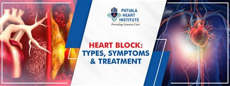 Heart block: Symptoms, and Treatment - Patiala Heart Institute