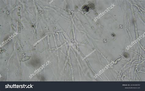 Fungal Hyphae Under Microscope Stock Photo 2234349797 | Shutterstock