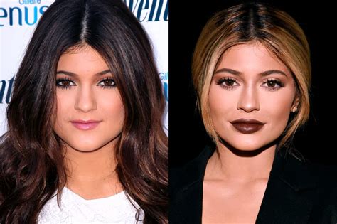 13 Of The Most Drastic Celebrity Plastic Surgeries