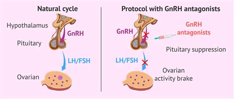 What is a short IVF protocol with GnRH antagonists?