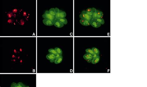 Fluorescence microscopy analysis of recombinant tachyzoites expressing... | Download Scientific ...