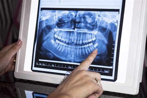 dental x-rays Panoramic x-ray | Hancock Village Dental | Dentist ...