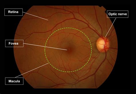 Retina - Gene Vision