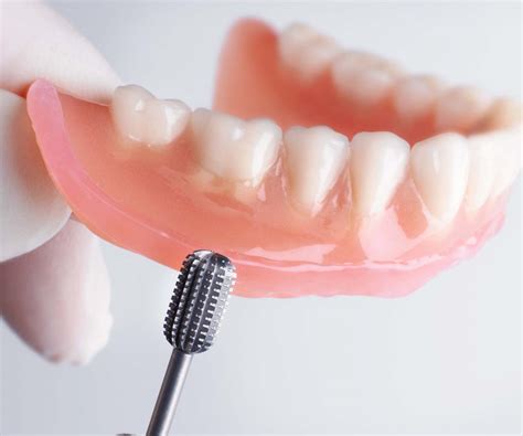 Soft Denture Liners - Edmonton South Centre Denture Clinic