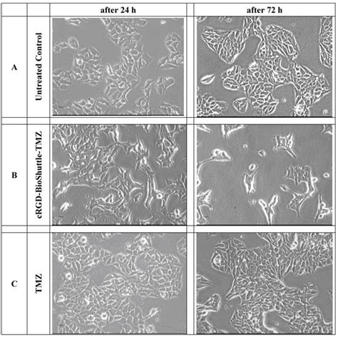 MCF-7 Cells