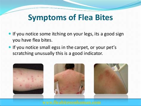 infected flea bite - pictures, photos