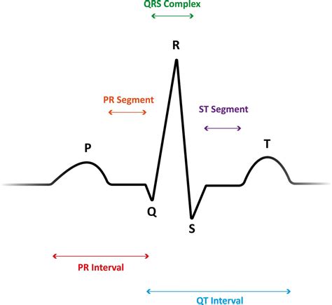 5-Lead ECG Interpretation (Electrocardiogram) Tips for Nurses – FRESHRN