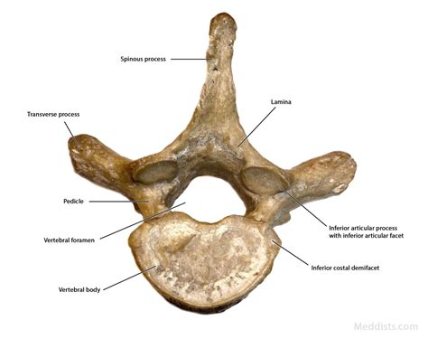 Thoracic Vertebrae Anterior View