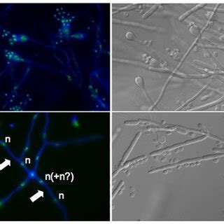 Basidia and basidiospores morphology differ between the two strains of... | Download Scientific ...