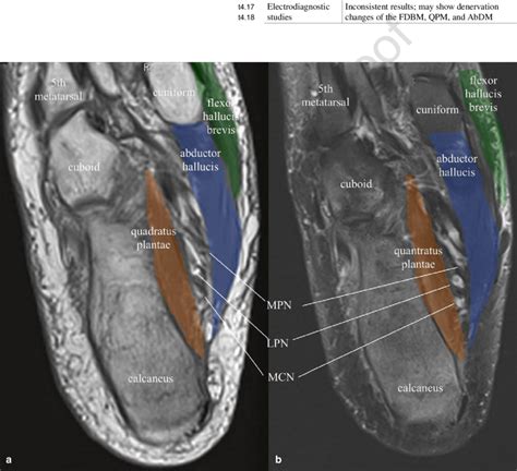 Plantar Foot Muscles Mri / Foot Ankle And Calf Musculoskeletal Key ...