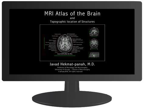 Atlas | JHP MRI Brain Atlas