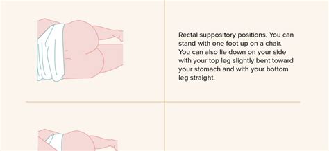 Suppositories for hemorrhoids – action, indications, contraindications, price. How to apply ...